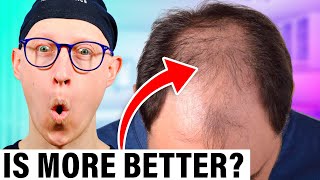 How Many Grafts Do I Need  Hair Transplant [upl. by Elamrej]