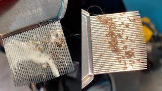 CloseUp Of Lice Infestation Removal [upl. by Dwane871]