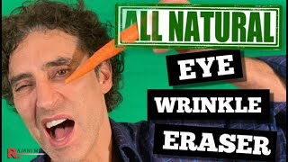 Eye Wrinkle Treatment  All Natural Under Eye Filler Before After [upl. by Elletsirhc]