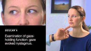 Examination of Gaze Holding Deficit Gaze Evoked Nystagmus [upl. by Oiznun]