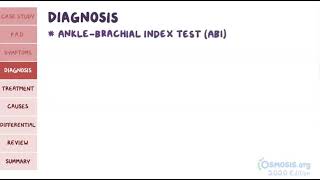 Peripheral Artery Disease  Osmosis [upl. by Kobe439]