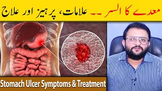 Stomach Ulcer Symptoms amp Treatment  Stomach Ulcer Ka Ilaj  Maidey Ka Ulcer  Dr Raja Omer Fiaz [upl. by Kyre]