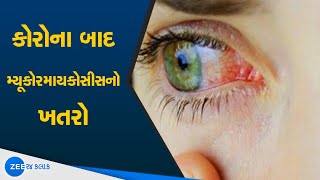 What are the symptoms of mucormycosis  શું છે મ્યુકોરમાઈકોસિસ  Watch on ZEE 24 Kalak [upl. by Eelak859]