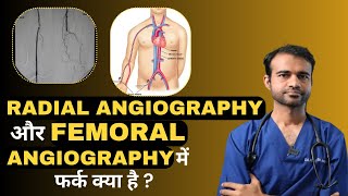 Angiography कराने से पहले कौनसे Test जरूरी है   Radial और Femoral Angiography में क्या फर्क है [upl. by Enilrahc]