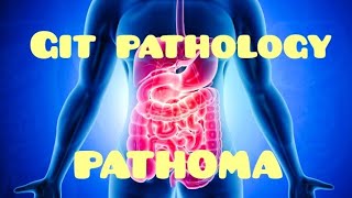 GIT PATHOMA 1Oral cavitySalivary glandsspecialpathology pathoma pathomalectures [upl. by Ellekcim]