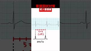 【看護国試対策】心電図で見る心拍数の測り方を分かりやすく解説【成人看護】 [upl. by Nohsav520]