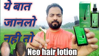 Neo Hair Lotion results how to use [upl. by Warden]