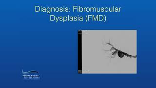 When Renal Artery Aneurysms Are A Nightmare [upl. by May]