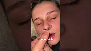 Instantly stops snoring🤯🤯 mouthbreathing snoringhusband snoring snoreclips sleepapnea [upl. by Annoel571]