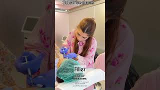 Lips Fillers before and after treatment watch full video 2024 foryou skincare india pakistan [upl. by Eelirem247]