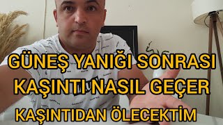 güneş yanığı kaşıntısı nasıl geçer [upl. by Assirrac]