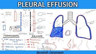 pleural effusion pathophysiology in Hindi part 1 [upl. by Susej896]