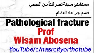 Pathological fractures Prof Wisam Abosena Nasrcity online lectures 2020 [upl. by Drofwarc]