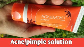 5 years of experience on using acne moist moisturizer  Honest review for acne prone skin [upl. by Aihsyak]