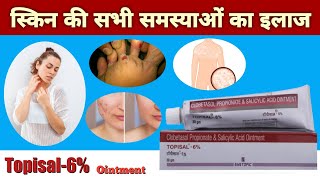 Topisal 6 Persent Ointment For Acne Pimples Psoriasis Skin Infection Eczema Contact Dermatitis [upl. by Aivatnwahs794]