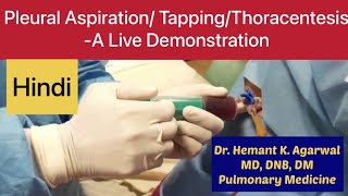 Pleural Aspiration Pleural Tapping Thoracentesis Needle Pleurocentesiss HINDI [upl. by Aserej235]