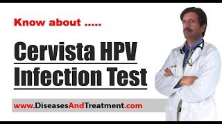 HPV Test Cervista Human Papillomavirus Infection Test in Women [upl. by Notsuoh579]