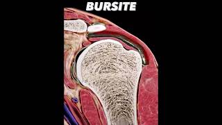 Bursite of the shoulder anatomy neet usmlestep upperlimbanatomy [upl. by Eirffej]