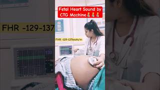 fetal heart sound by CTG machineroutine care [upl. by Dygall]