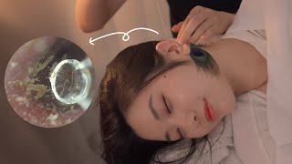 ASMR 보면서 받는 귀청소👂  내시경 구름칼 공작털 솜털  Visual Ear Cleaning asmr [upl. by Lachlan]