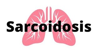 Sarcoidosis A Review rheumatology sarcoidosis [upl. by Rennold]