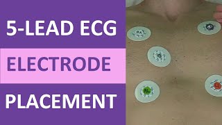 5 Lead ECG Placement of Electrodes EKG NCLEX amp Nursing Mnemonic [upl. by Tarra]