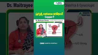 Intrauterine Devices to Prevent Pregnancy  Copper T  Sankhya Hospitals  shorts contraceptives [upl. by Eicyac]