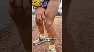 TEARING knee cartilage by running a week of marathons [upl. by Hyatt793]