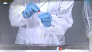 Sample collection in live birds blood tracheal and cloacal swat [upl. by Celisse]