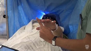 Dr Mark Lyons  Deep Brain Stimulation Precision Using Segmented Leads [upl. by Llertnek]