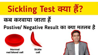 Sickling Test in Hindi  Use Postive and Negative Result Means  Price  Sickle Cell Anemia [upl. by Mel]