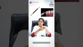 What is Operculectomy  Siri Dental Hospital  Best Dental Hospital  Invisalign Hyderabad [upl. by Geof]