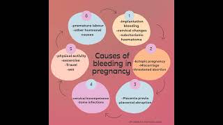 bleedingspotting in pregnancy [upl. by Miah]