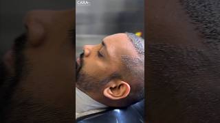 Head Wash After Hair Transplant  Scabs Removal Hair wash [upl. by Naujud]