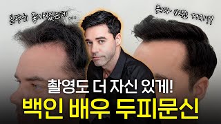 신경 쓰이는 M자 헤어라인🤔 모발이식은 부담스럽다면 두피문신이 답 이젠 촬영이 더 자신 있어요 [upl. by Sorensen]