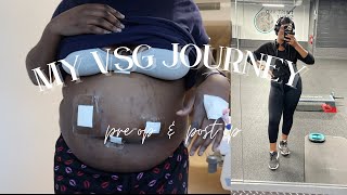 MY WEIGHTLOSS JOURNEY WITH GASTRIC SLEEVE SURGERY  PREOP amp POSTOP DIARY amp 40LBS WEIGHTLOSS  VSG [upl. by Barna]