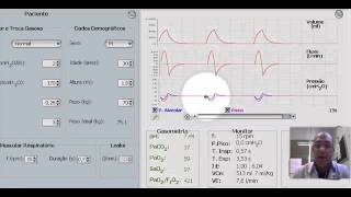 Instalação da Insuficiência Respiratória Aguda  Crise de broncoespasmo 1 de 4 [upl. by Minton]