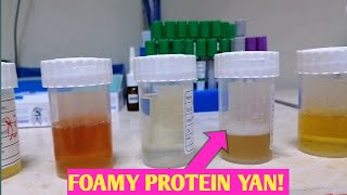 ETO PATUNAY PAG FOAMY ANG IHI MAY PROTEIN YAN [upl. by Nanerb233]