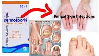 Dermosporin solution for fungal infections uses in urdu [upl. by Aenneea]