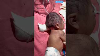 Long Time At Birth Cannel newbornbaby viralvideo [upl. by Joly]