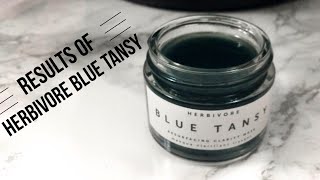 Results of Herbivore Blue Tansy Resurfacing Clarify Mask after 3 weeks [upl. by Blaze]