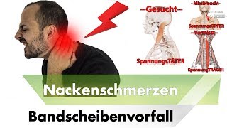 NACKENSCHMERZEN amp HWS Bandscheibenvorfall  Symptome Ursachen amp Lösungen [upl. by Fadden]