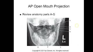 Cervical amp Thoracic Spine Anatomy Part 4 of 7 [upl. by Baynebridge]