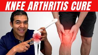 Can Knee Arthritis Actually Be CURED [upl. by Adohr]