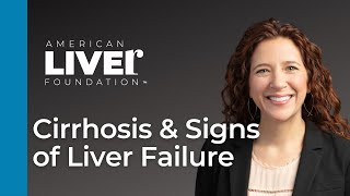 Progression of Liver Disease Webcast Series Cirrhosis and Signs of Liver Failure [upl. by Ecnaled]