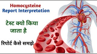 homocysteine blood test report II Homocysteine blood test [upl. by Vins]