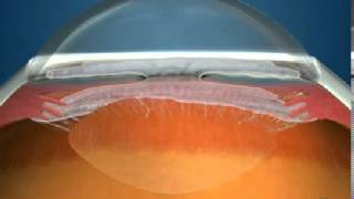 How Fluid Circulates in the Eye [upl. by Saleme]