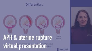 Antepartum haemorrhage amp uterine rupture [upl. by Leen233]