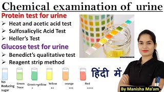 Urine Examination Part2 Chemical examination of urine  Urinalysis in hindi  Examination of urine [upl. by Noneek197]