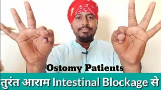 How to Help Clear an Intestinal Blockage Hindi  Exercise for Ostomy Patients to avoid gas Blockage [upl. by Amej]